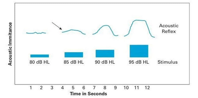 Acoustic Reflex Testing