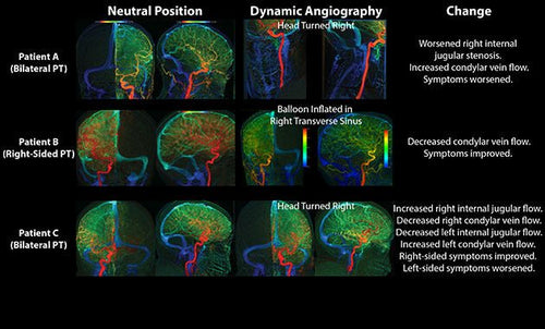 Causes Of Tinnitus